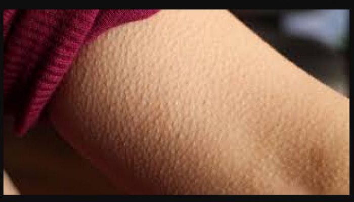 to get goosebumps