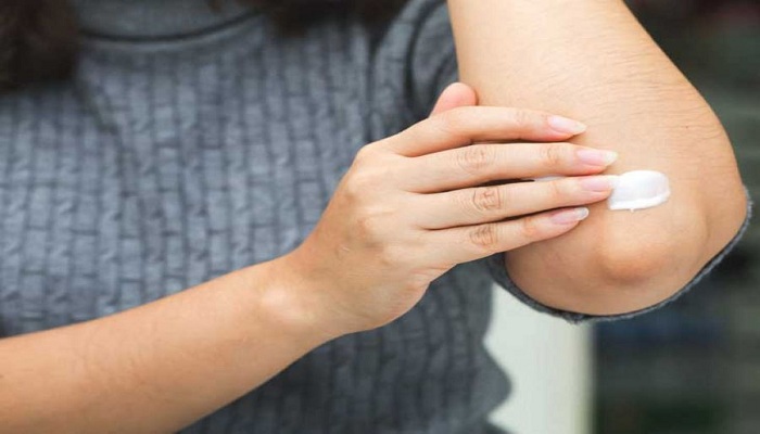 dark elbow