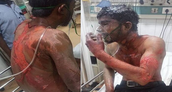 Acid attack