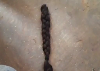 फिर आया चोटी कटने का मामला