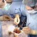 kidney transplantation