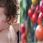tomato flu
