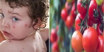 tomato flu
