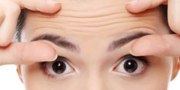 forehead line