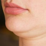 Double Chin