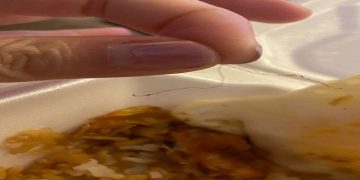 Hair in Food