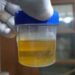 urine test