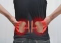 Kidney