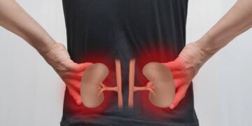 Kidney