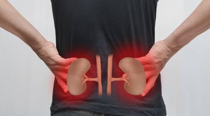 Kidney