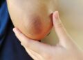 black elbow