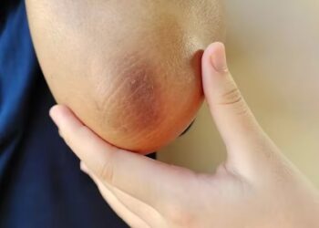 black elbow