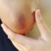 black elbow