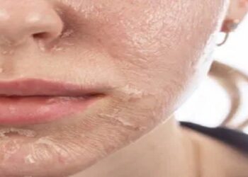 Dead Skin