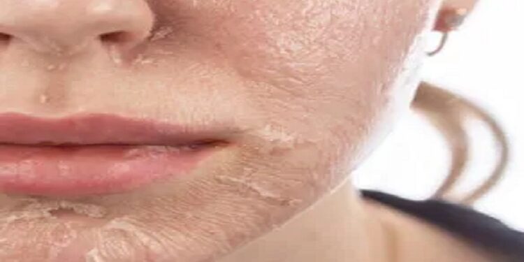Dead Skin