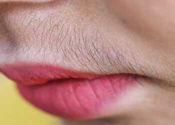 Unwanted Hair