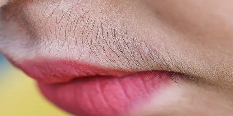 Unwanted Hair