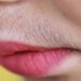 Unwanted Hair