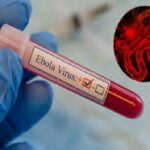 Ebola Virus