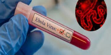 Ebola Virus