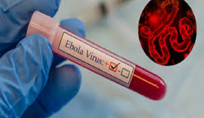 Ebola Virus