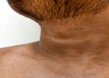 Black Neck
