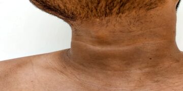Black Neck
