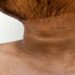 Black Neck