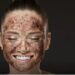 Coffee Face Pack
