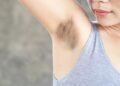Dark Underarms