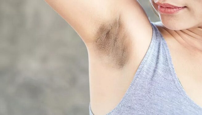 Dark Underarms