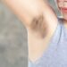 Dark Underarms