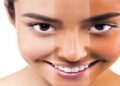 Skin Tanning