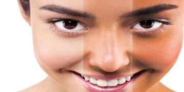 Skin Tanning