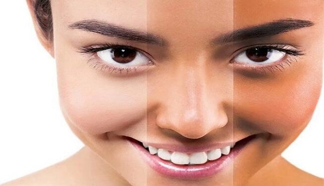 Skin Tanning