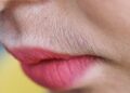Unwanted Hair