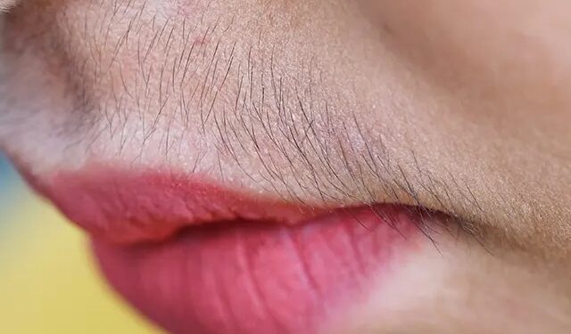 Unwanted Hair