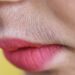 Unwanted Hair