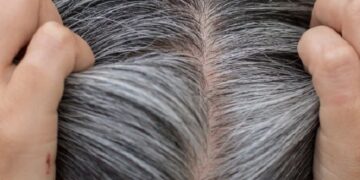 White Hair