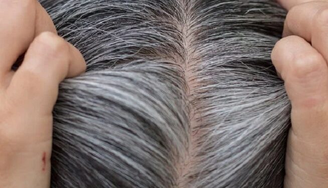 White Hair